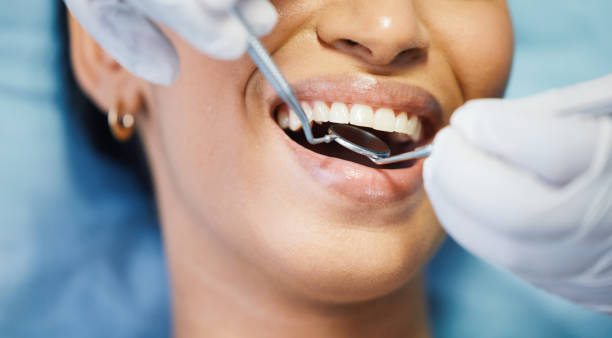 Best Broken or Cracked Tooth Emergency Dentist in La Grande, OR