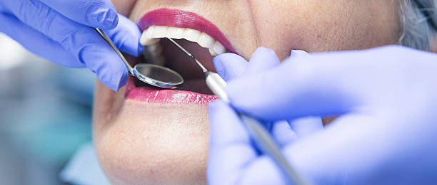 Best Emergency Dentist for Knocked-Out Tooth in La Grande, OR